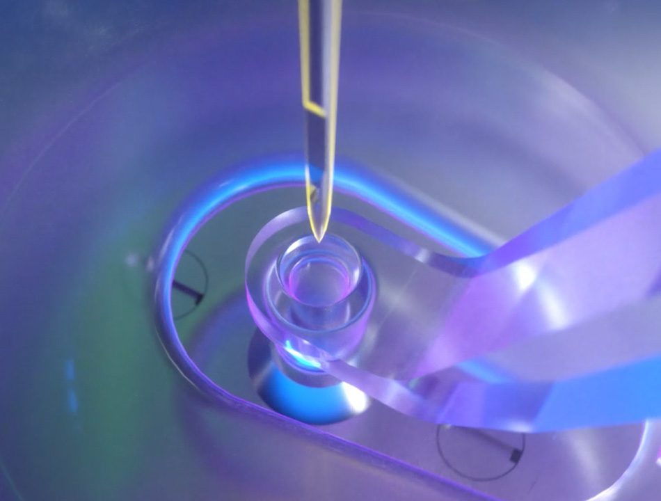 Self-Adapting Needle and Needle Plate Hole Design for Easy and Efficient Relocation and Installation